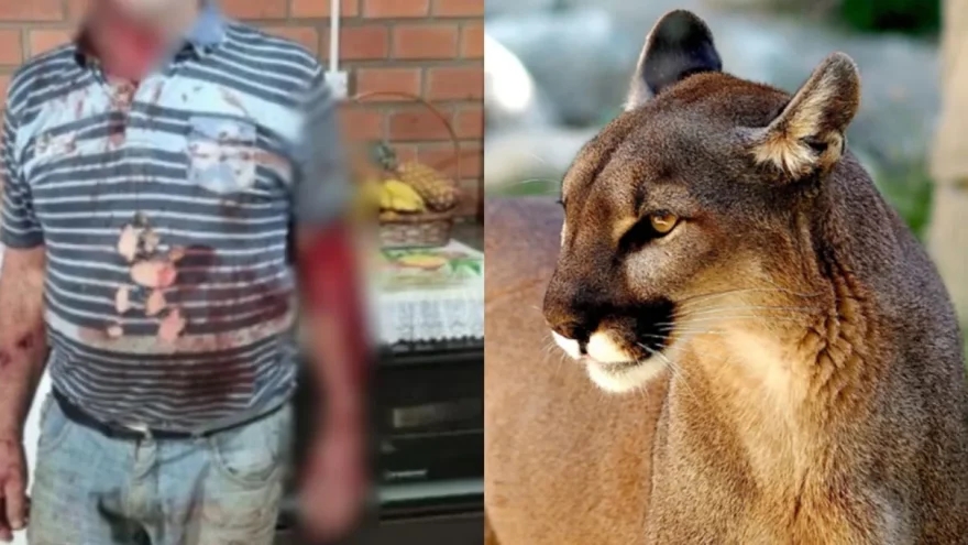 Mais um ataque: Agricultor afirma que enfrentou onça-parda e mostra ferimentos provocados por animal
