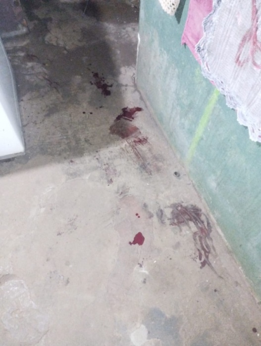 Mesmo ferida, menina de 12 anos aciona bombeiros e salva família de agressor armado com faca e martelo, em Toledo