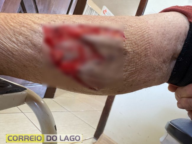 Cão feroz ataca moradores em Moreninha, Santa Helena